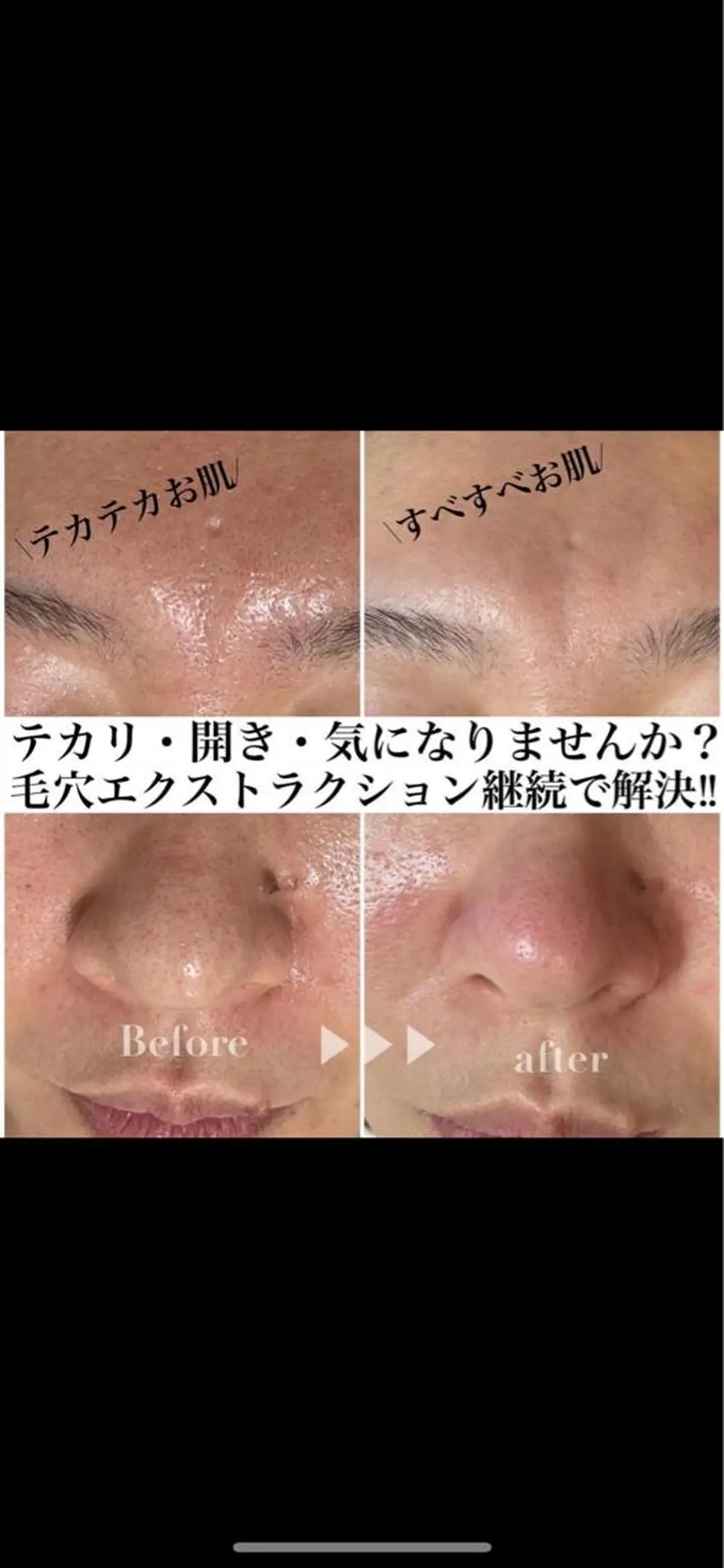 BELINDA HITOMIのマツエク・マツパデザイン