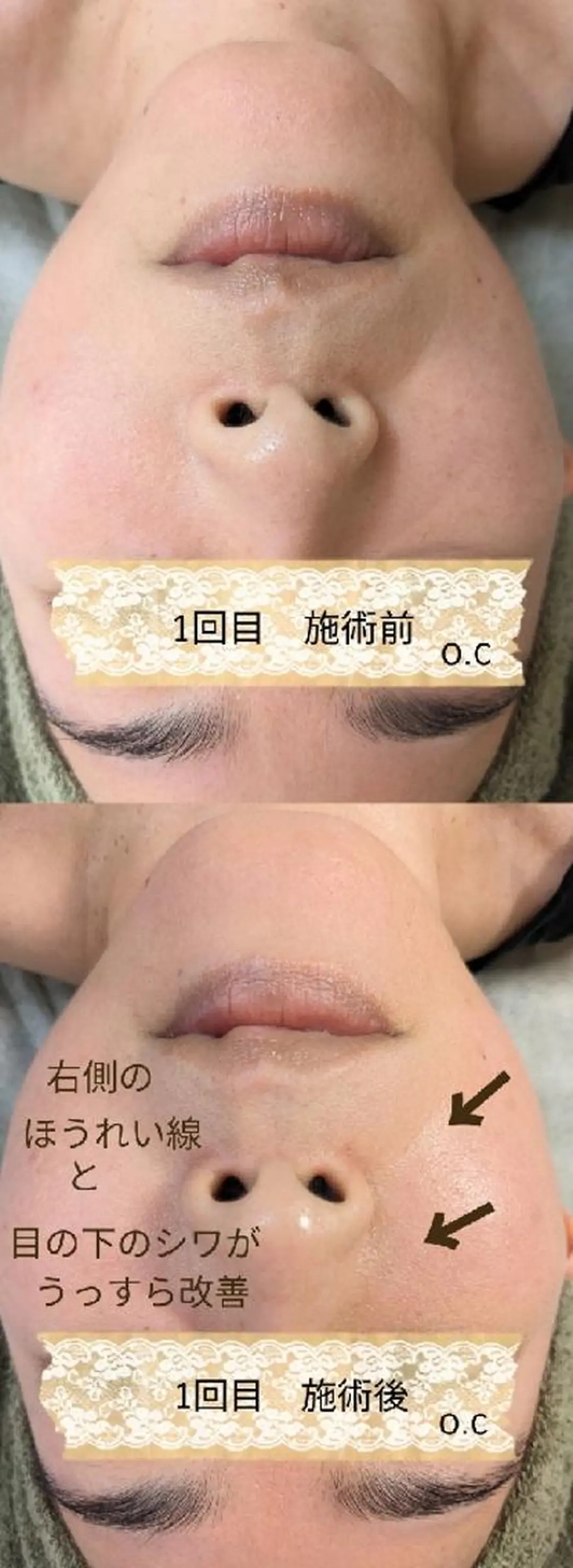 プライベートサロン宿り木所属・江坂@宿り木　脱毛＆ 耳ツボジュエリーのその他イメージ