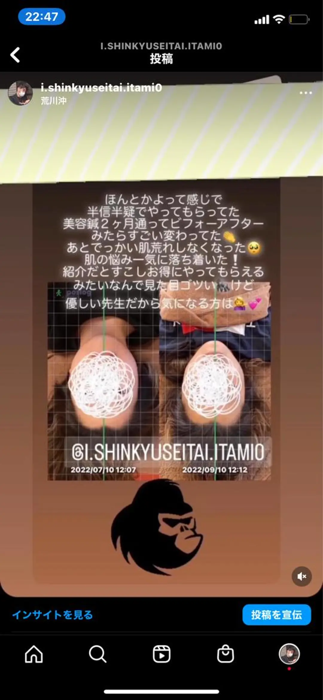 エステ リラク i鍼灸整体院所属・i鍼灸整体院 石井宏和のエステ・リラクイメージ