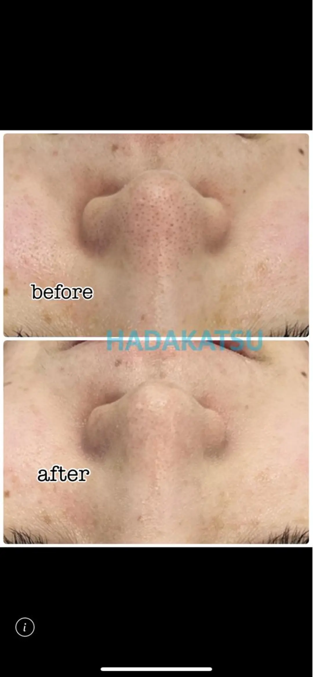 エステ 総合エステサロン 肌活のエステ・リラクイメージ