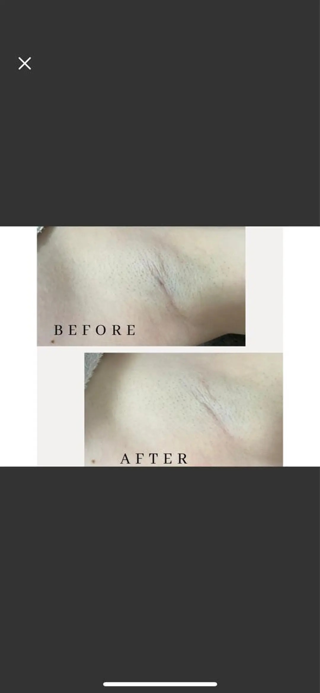 Its Yoshikaのエステ・リラクイメージ