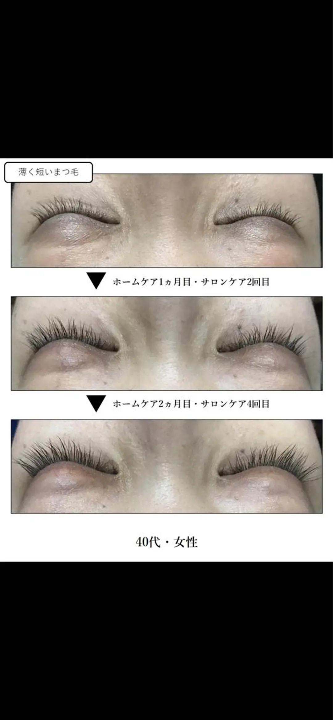 マツエク・マツパ ♾nail 恵美のマツエク・マツパデザイン