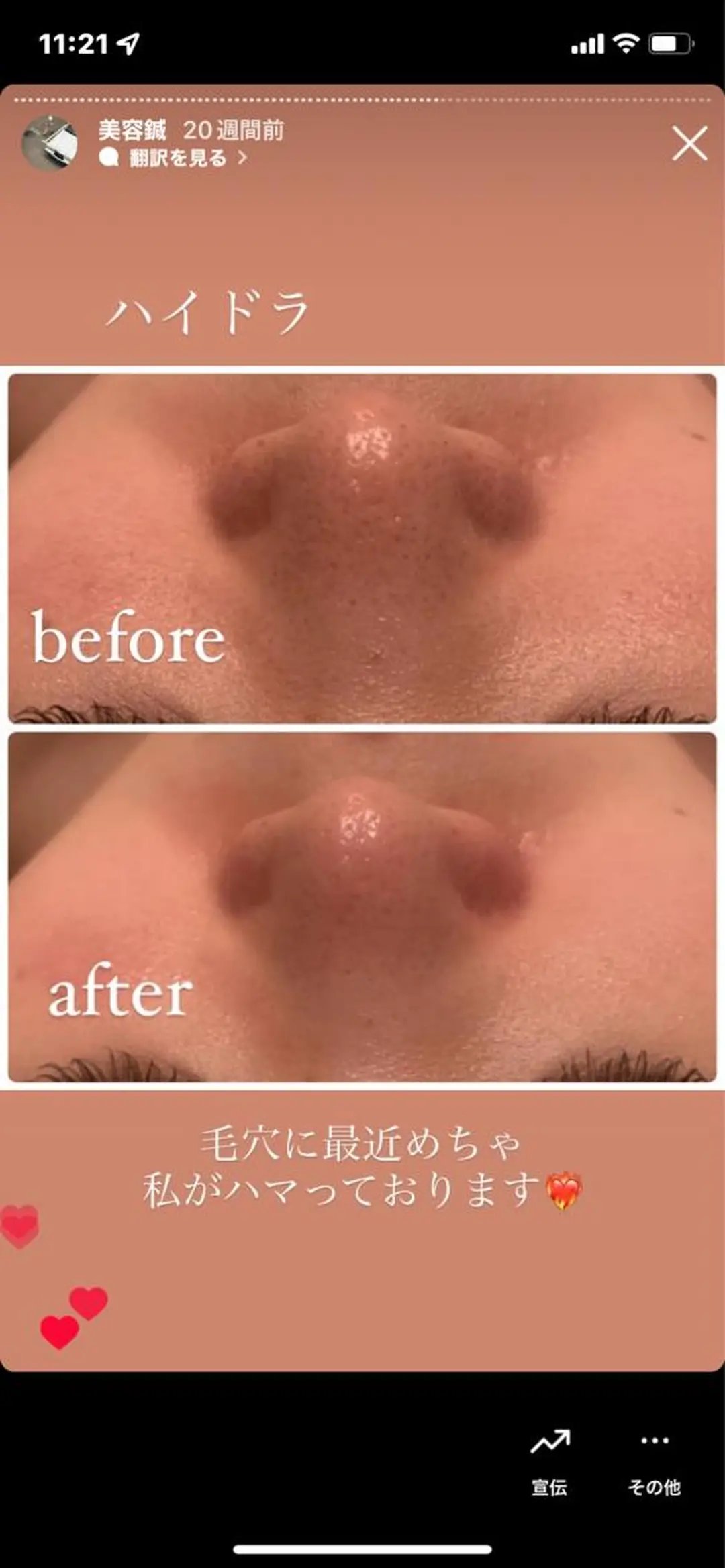 その他 種市 貴子のその他イメージ