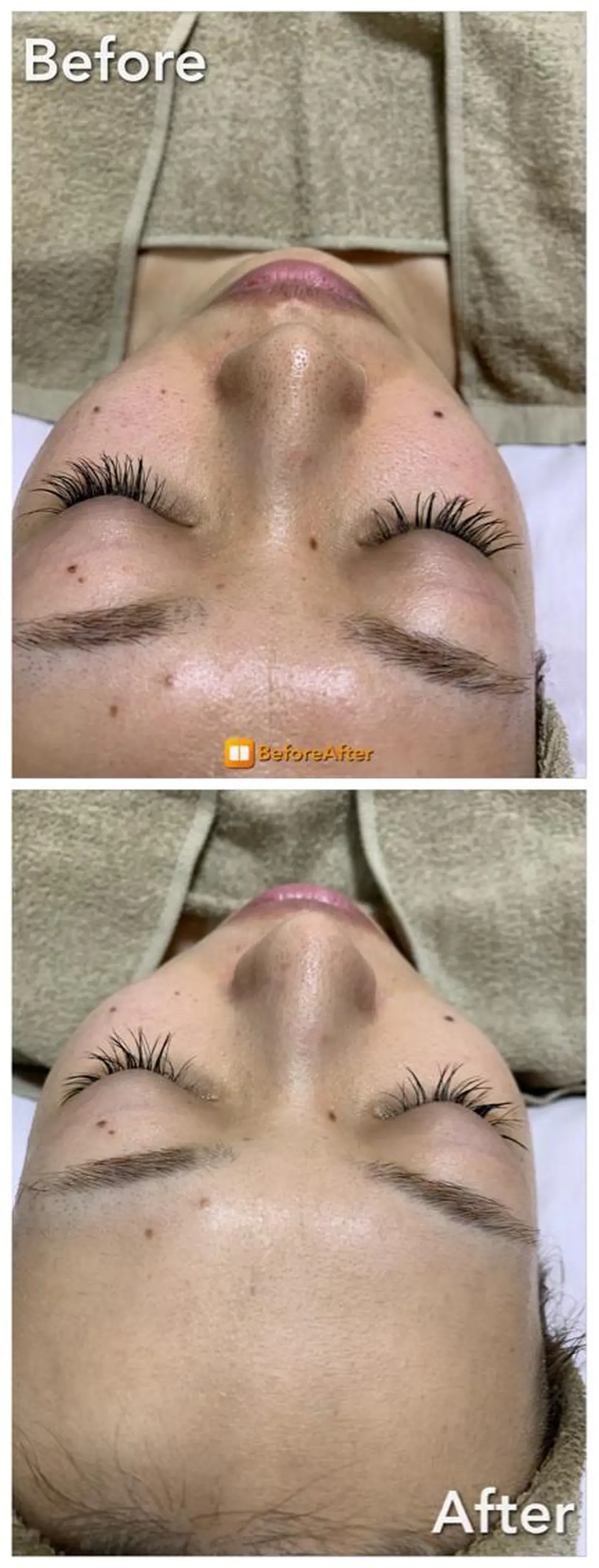 リラクゼーションエステサロン🌺肌質改善イアリイ所属・肌質再生 〜イア🌺リイ〜のエステ・リラクイメージ