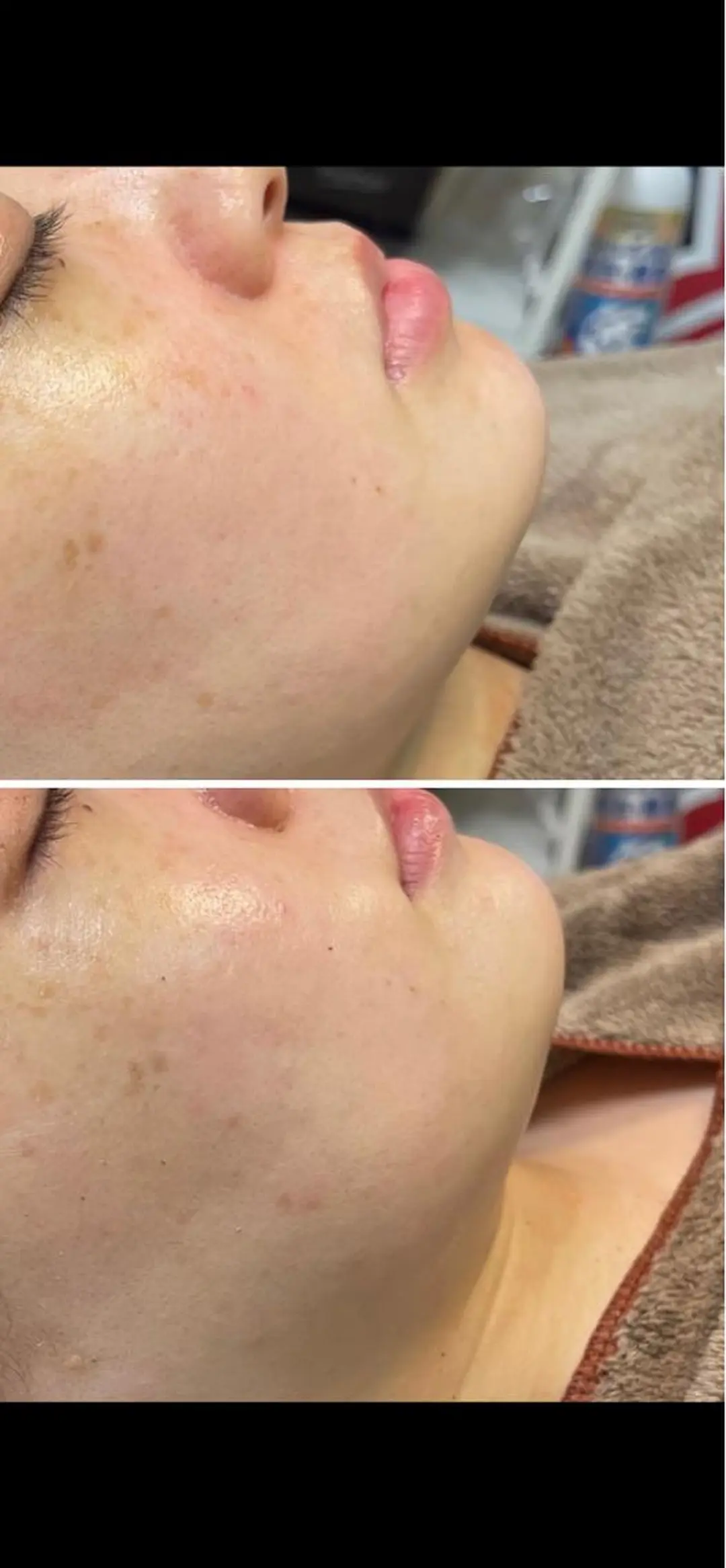 エステ リーズナブル光脱毛サロンOhana所属・永吉 ゆかりのエステ・リラクイメージ