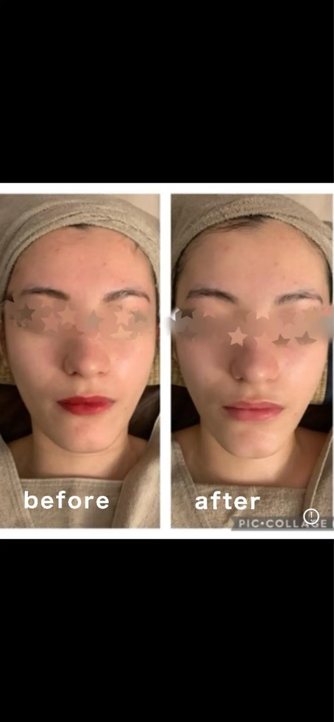 ボディ&フェイシャルサロン Vierouge所属・肌質改善・美肌サロン ヴィエルージュのエステ・リラクイメージ