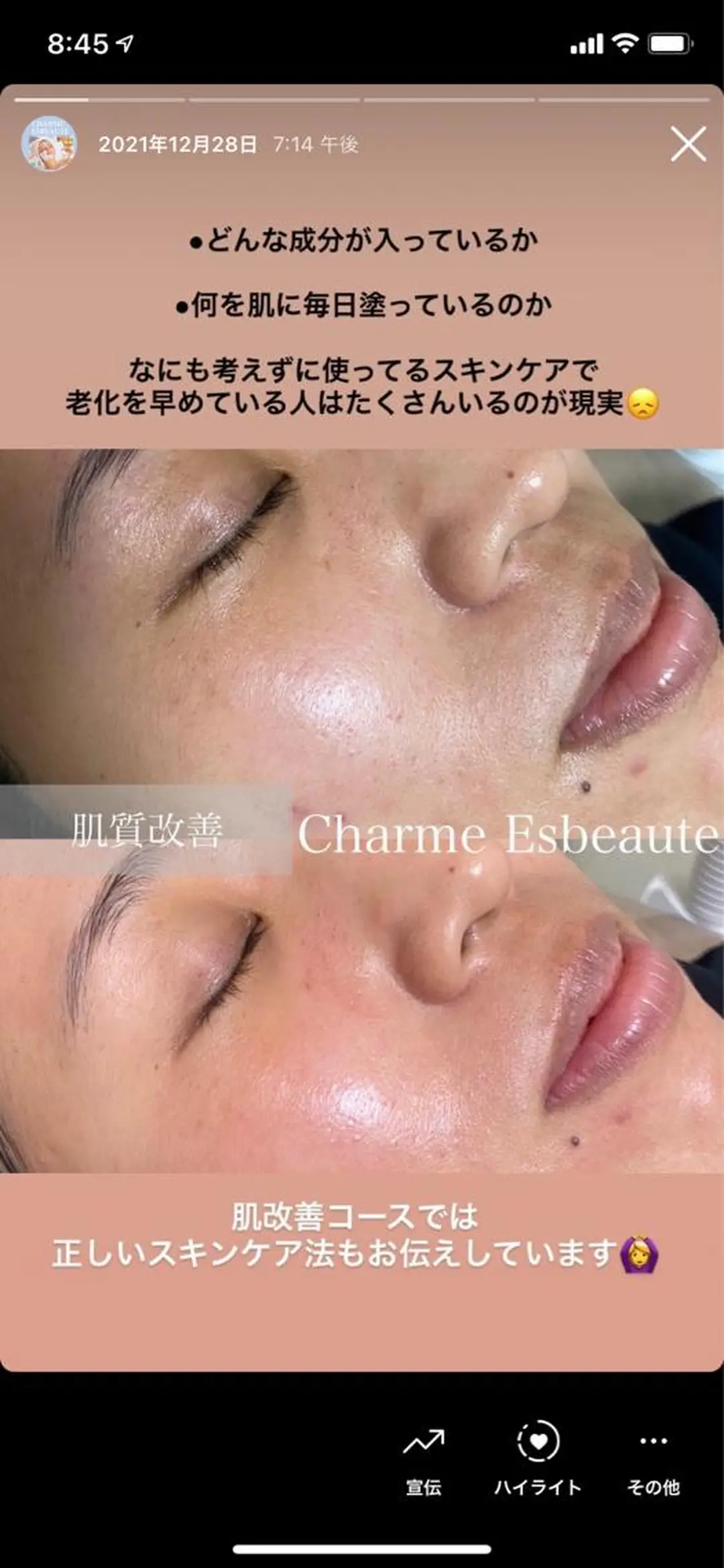 Charme Esbeaute所属・南森町LED エクパーマのマツエク・マツパデザイン
