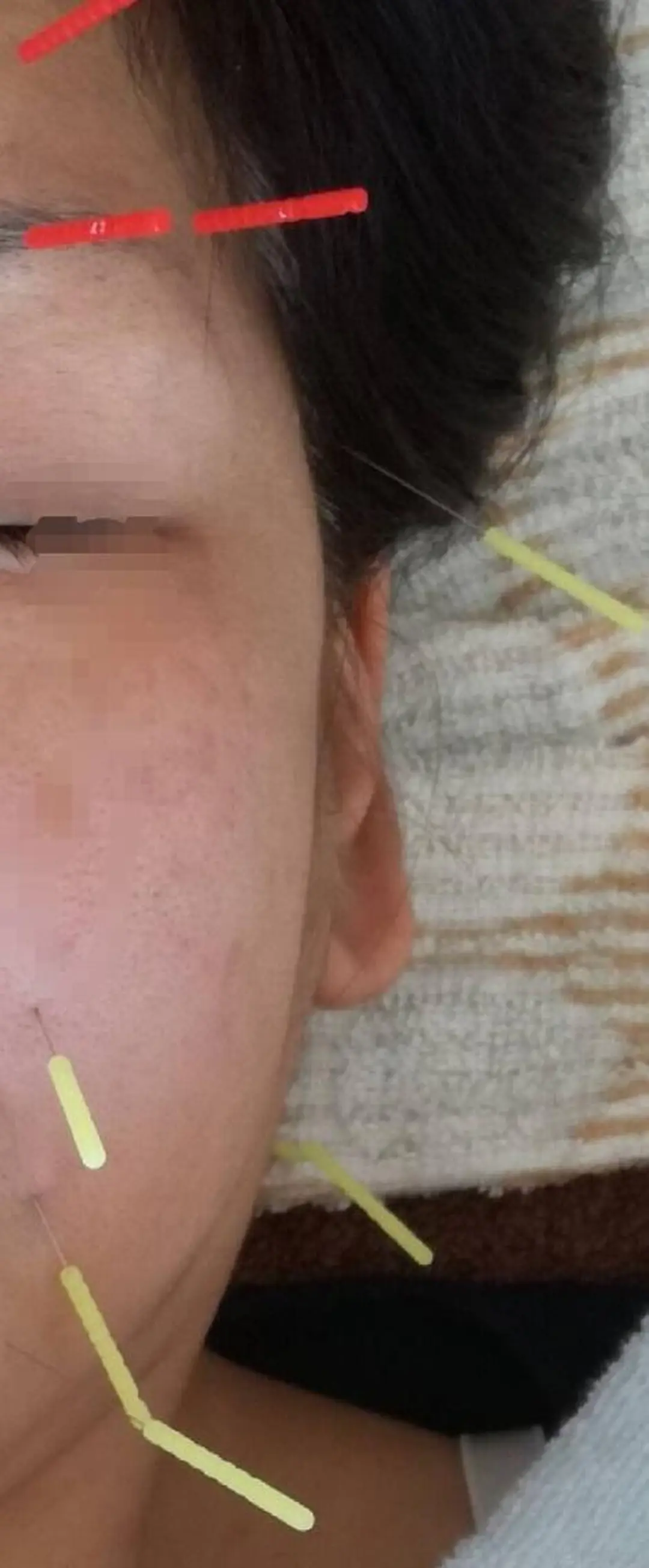 鍼灸・整体・美容鍼  ハリエのエステ・リラクイメージ