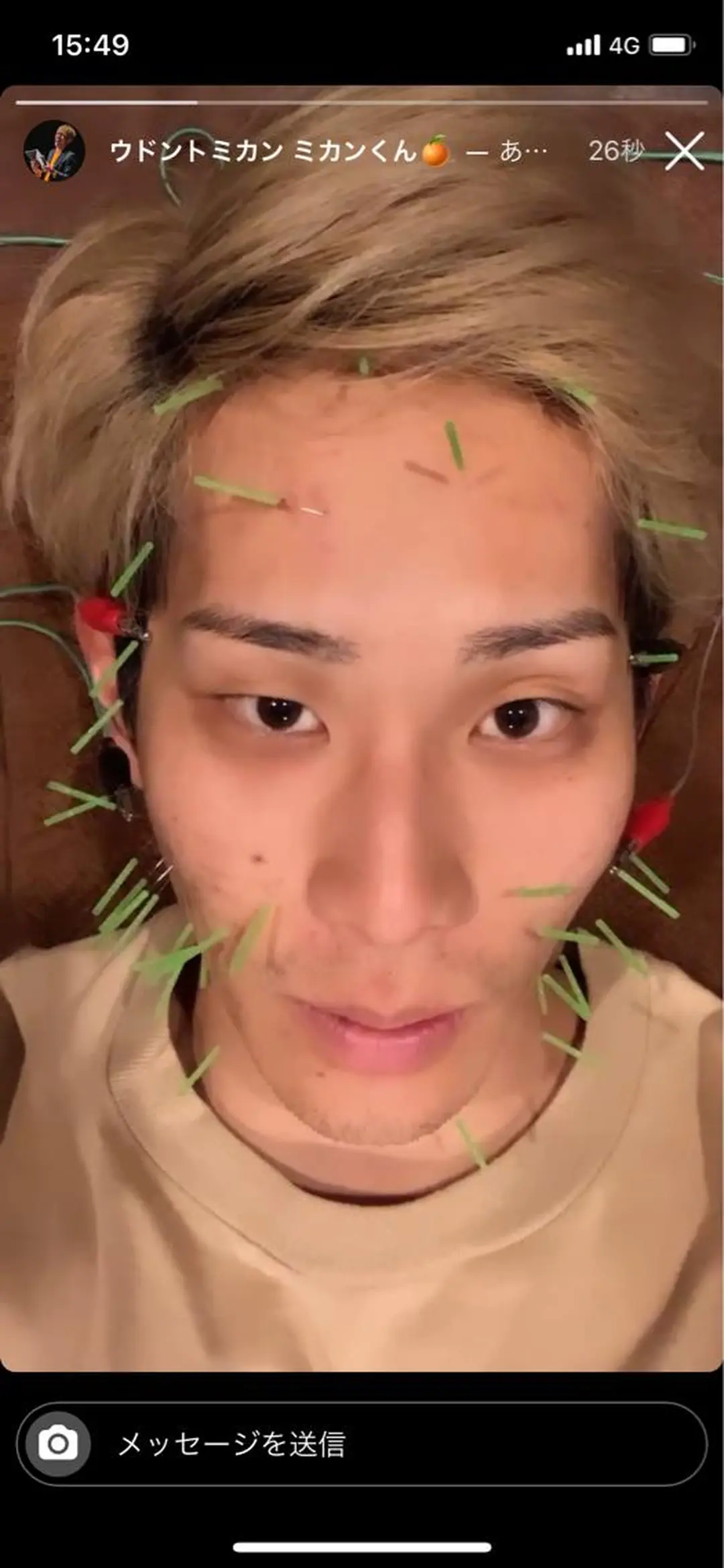 メンズ エステ リラク 美容鍼灸サロン LOMIHARIのエステ・リラクイメージ