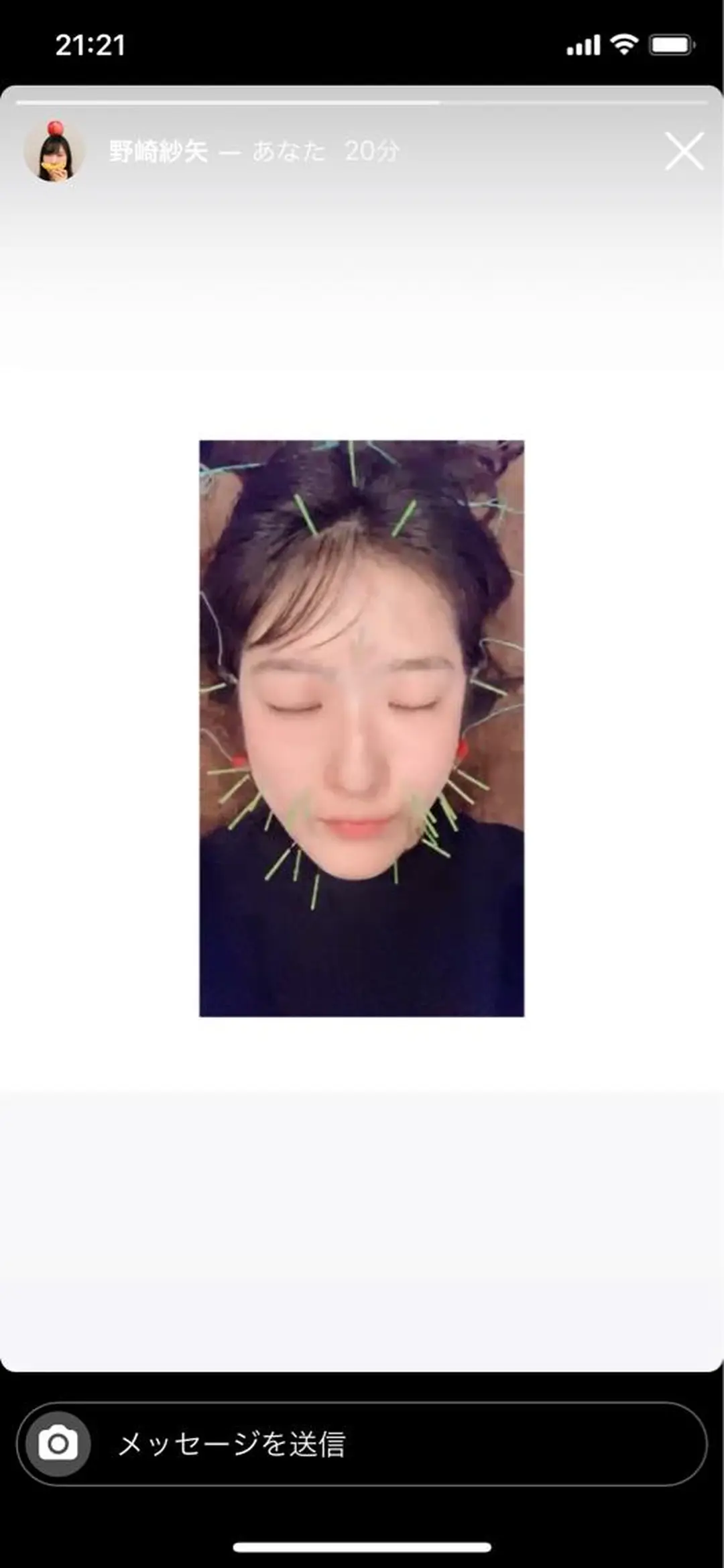 エステ リラク 美容鍼灸サロン LOMIHARIのエステ・リラクイメージ