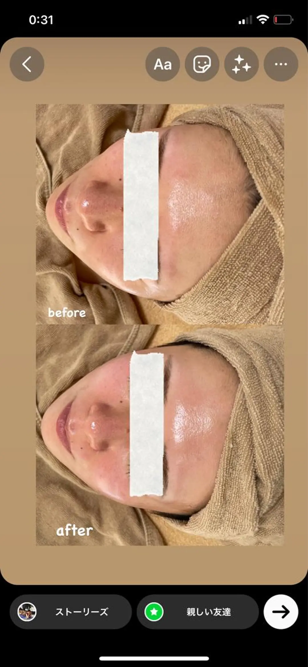 脱毛 エステサロン Mi-mi.iのエステ・リラクイメージ