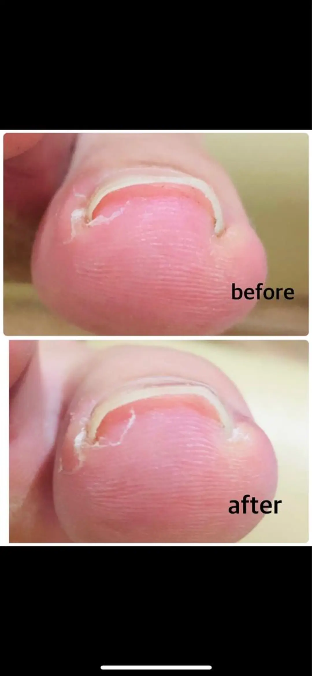 ネイル フットネイル レワード所属・reward＊安藤 ゆかりのネイルデザイン