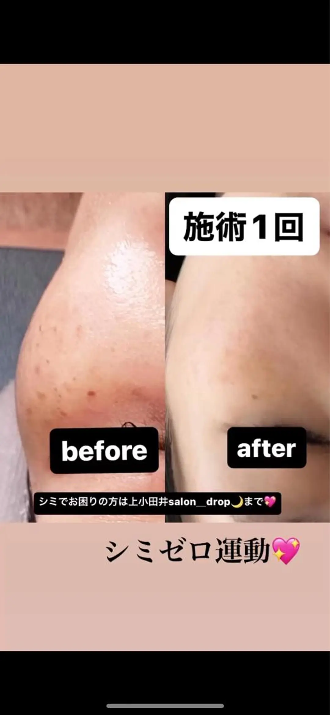 salon＿drop所属・salon dropのエステ・リラクイメージ