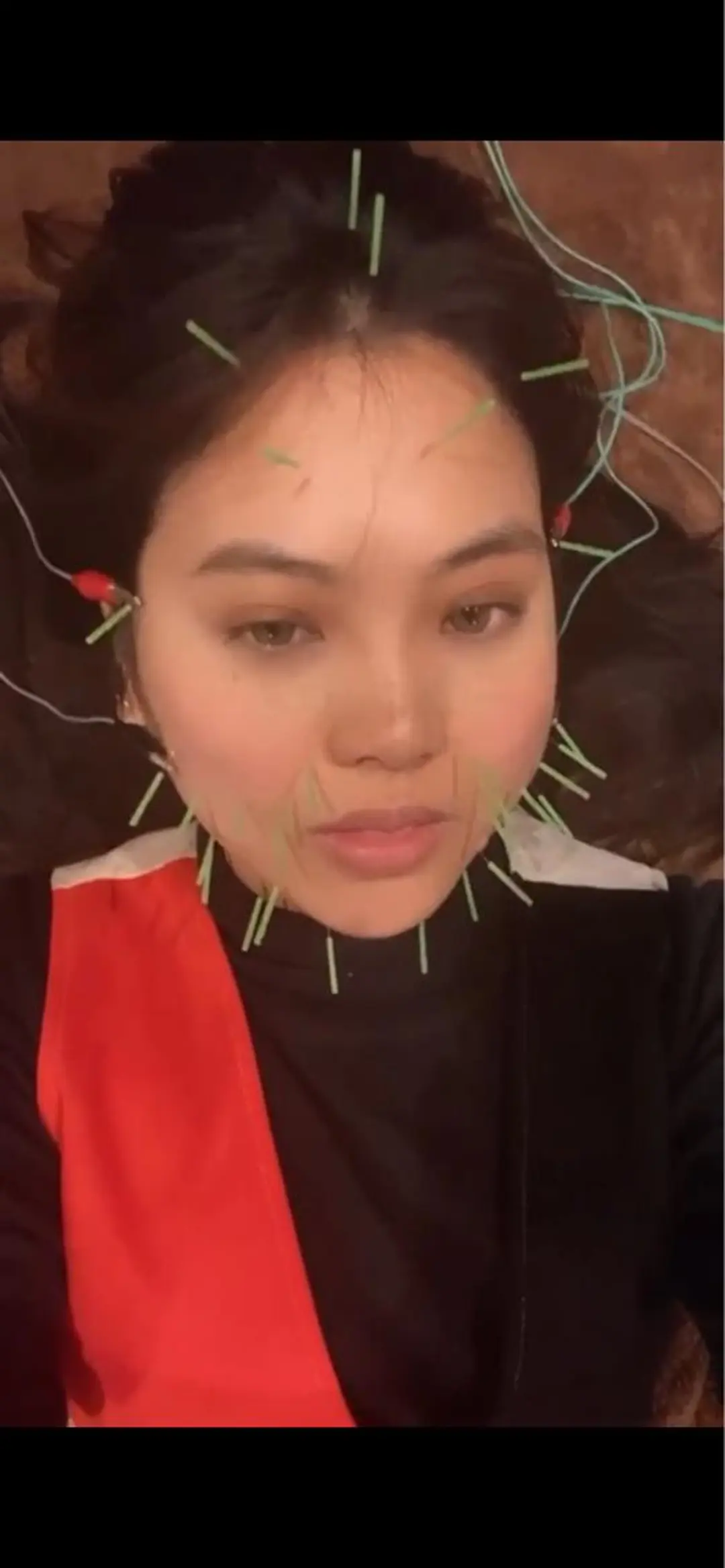 エステ リラク 美容鍼灸サロン LOMIHARIのエステ・リラクイメージ