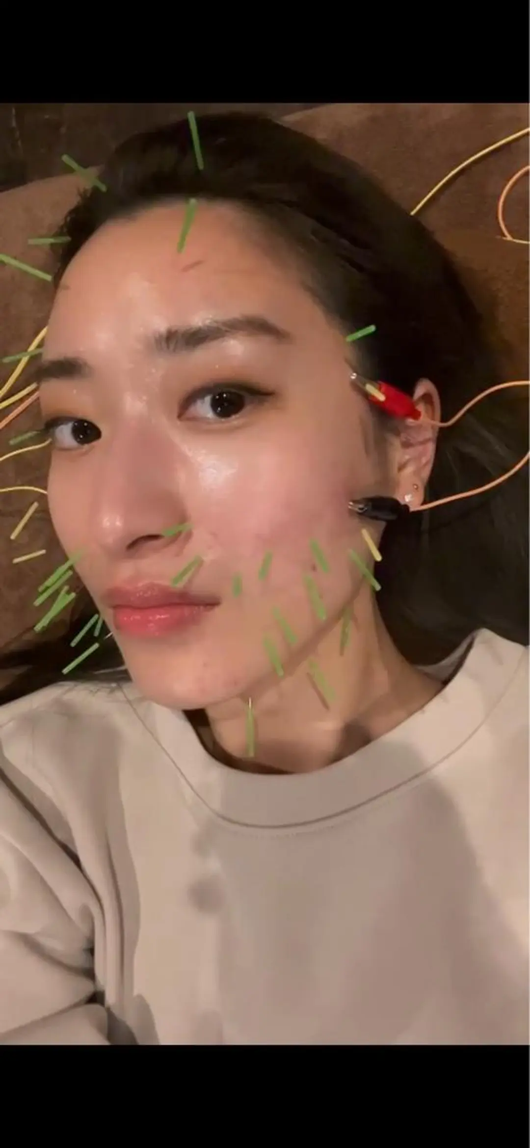 メンズ エステ リラク 美容鍼灸サロン LOMIHARIのエステ・リラクイメージ