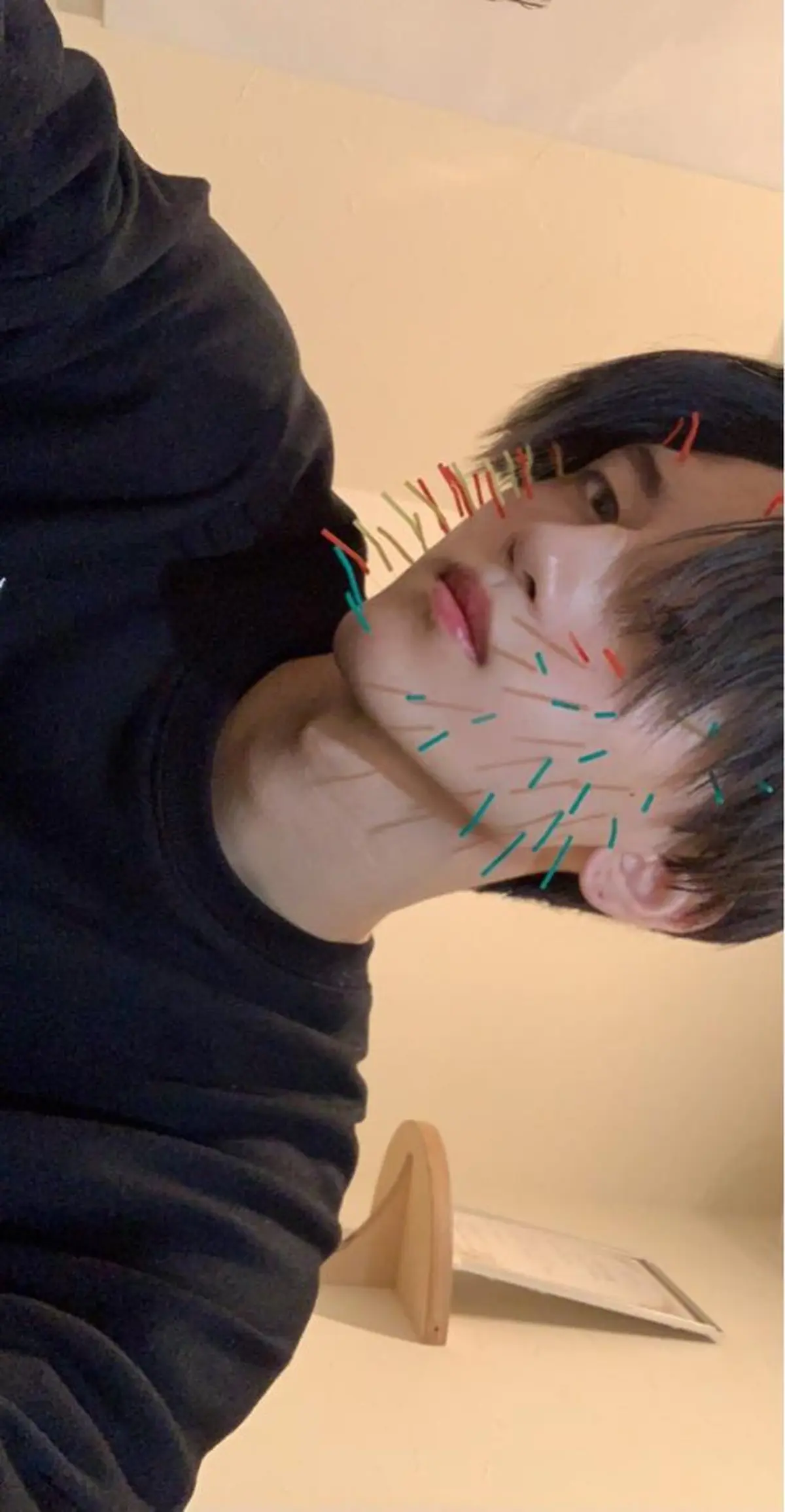 鍼灸 Refineのその他イメージ
