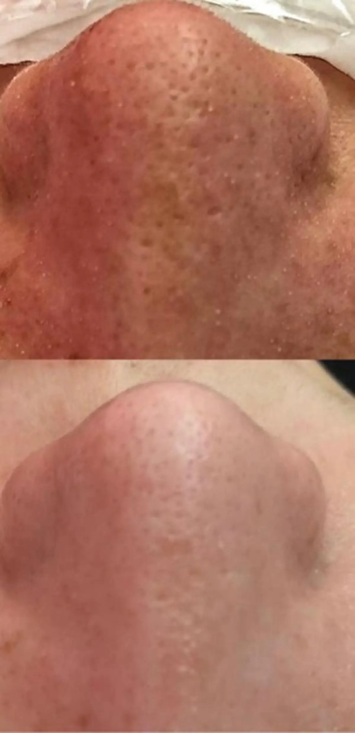 朝重い人専用 肩甲骨調整のエステ・リラクイメージ