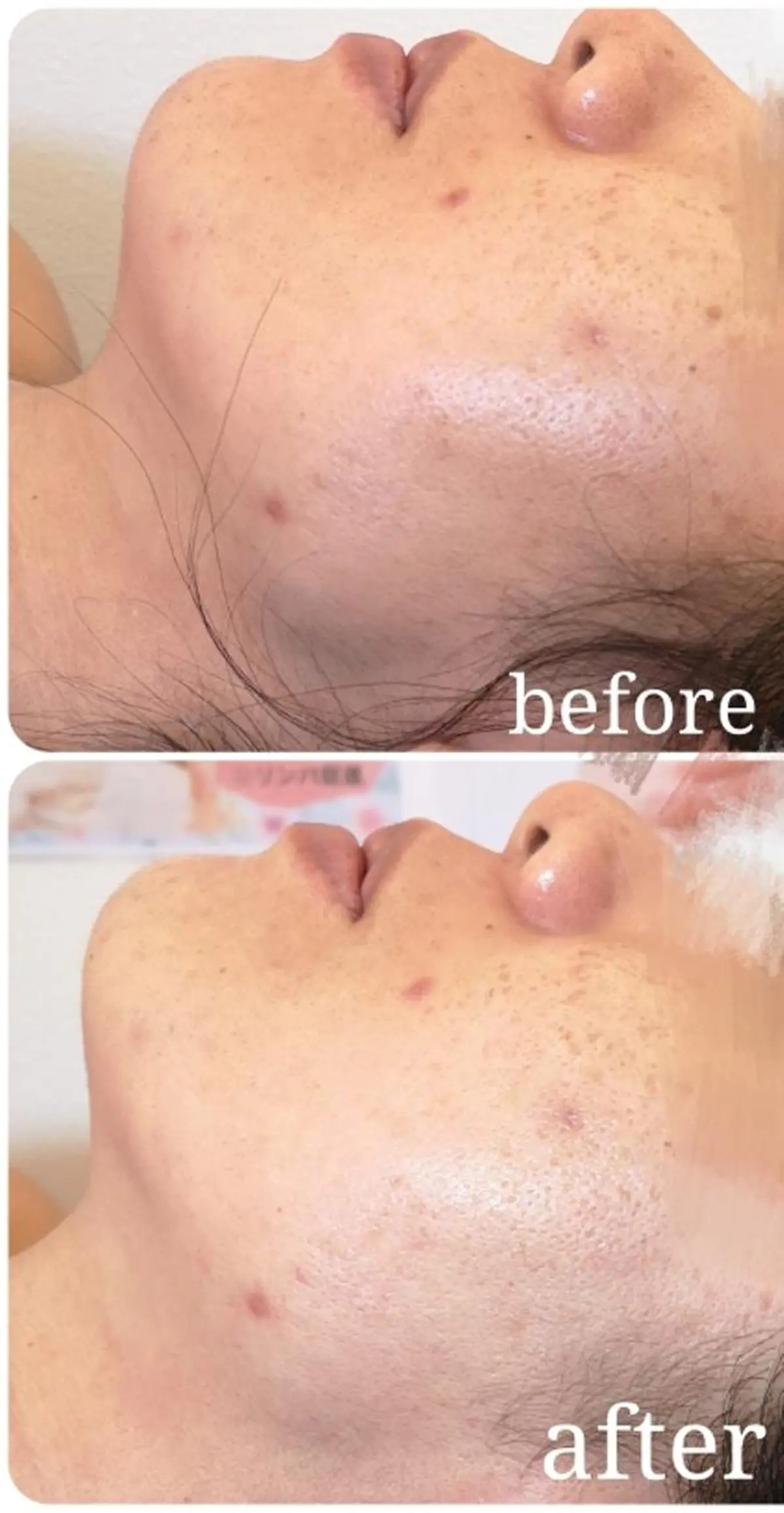 エステ 🅖🅤🅩🅔🅛 salonのエステ・リラクイメージ