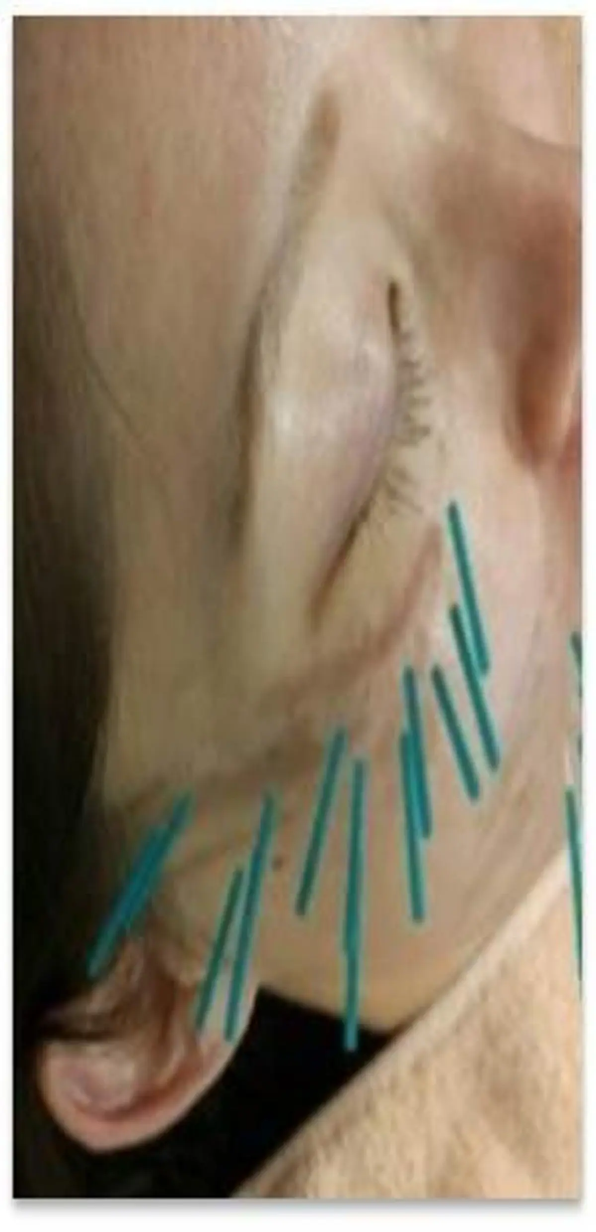 HARIS(ハリス) 院長Shimのエステ・リラクイメージ