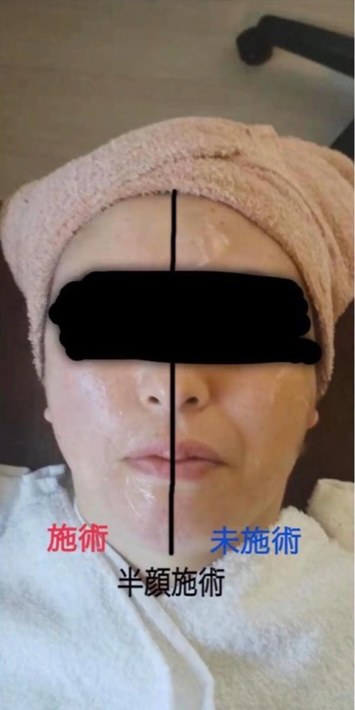 エステ Beauty Salon Mirei所属・ﾋﾞｭｰﾃｨｰｻﾛﾝ Mirei 山下の眉毛・アイブロウイメージ