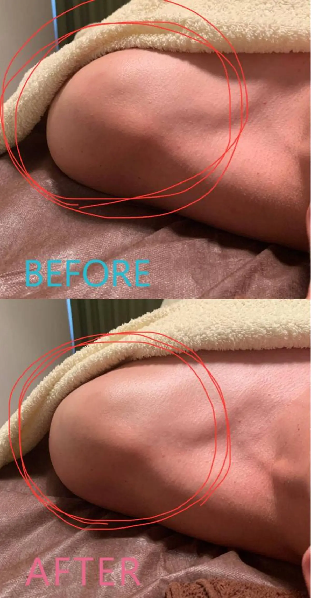 ハウオリベリー所属・うえば すみかのエステ・リラクイメージ