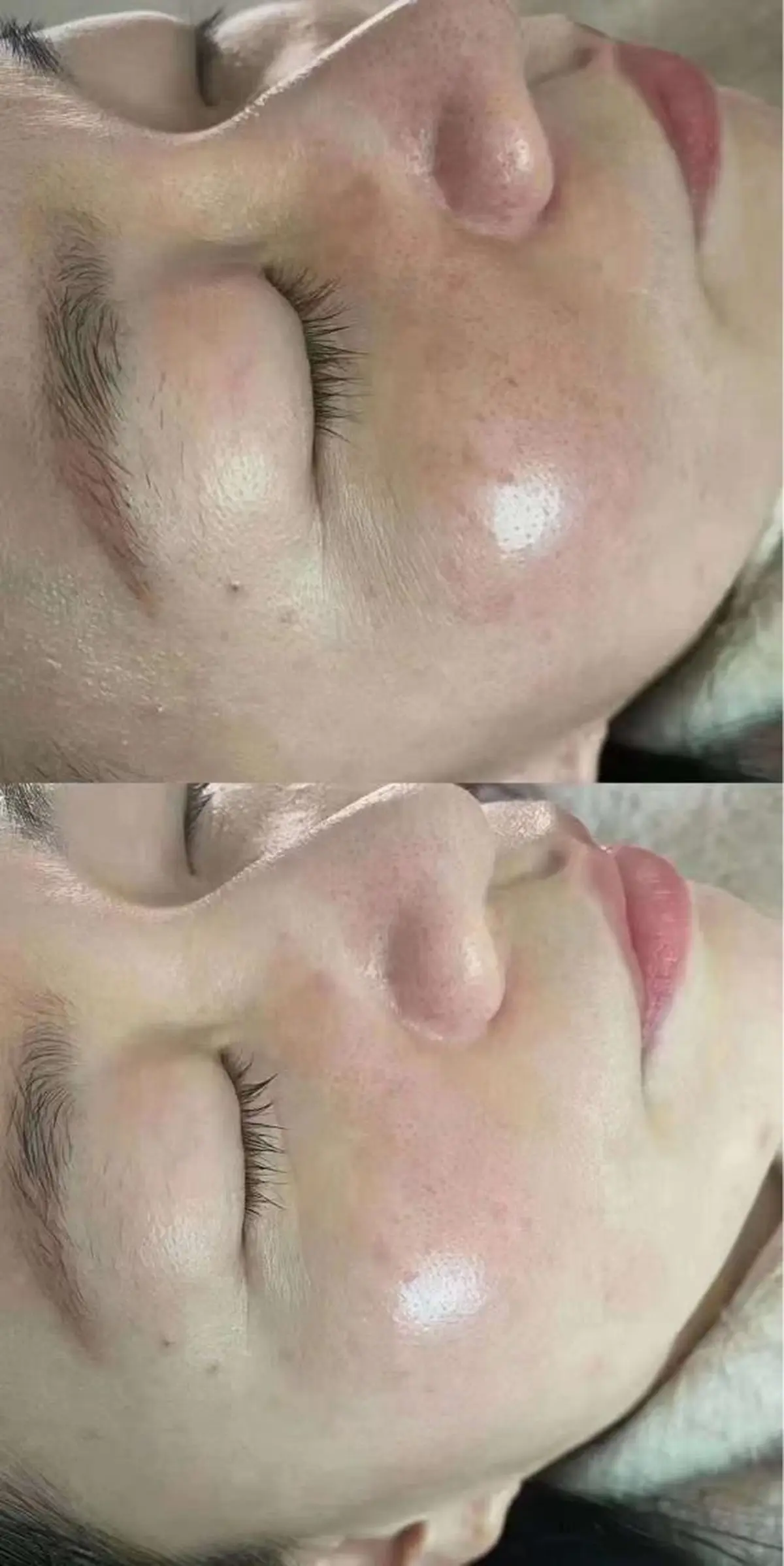 エステ aliaハイフ&水光ジェットサロン所属・aliaハーブ水光店 エステティシャン募集のエステ・リラクイメージ