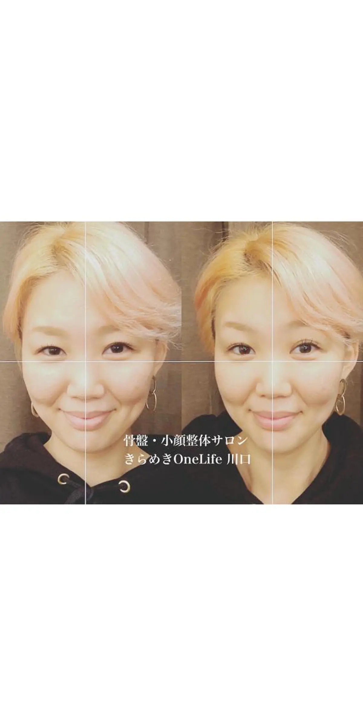 エステ リラク きらめきワンライフ Yumaのエステ・リラクイメージ