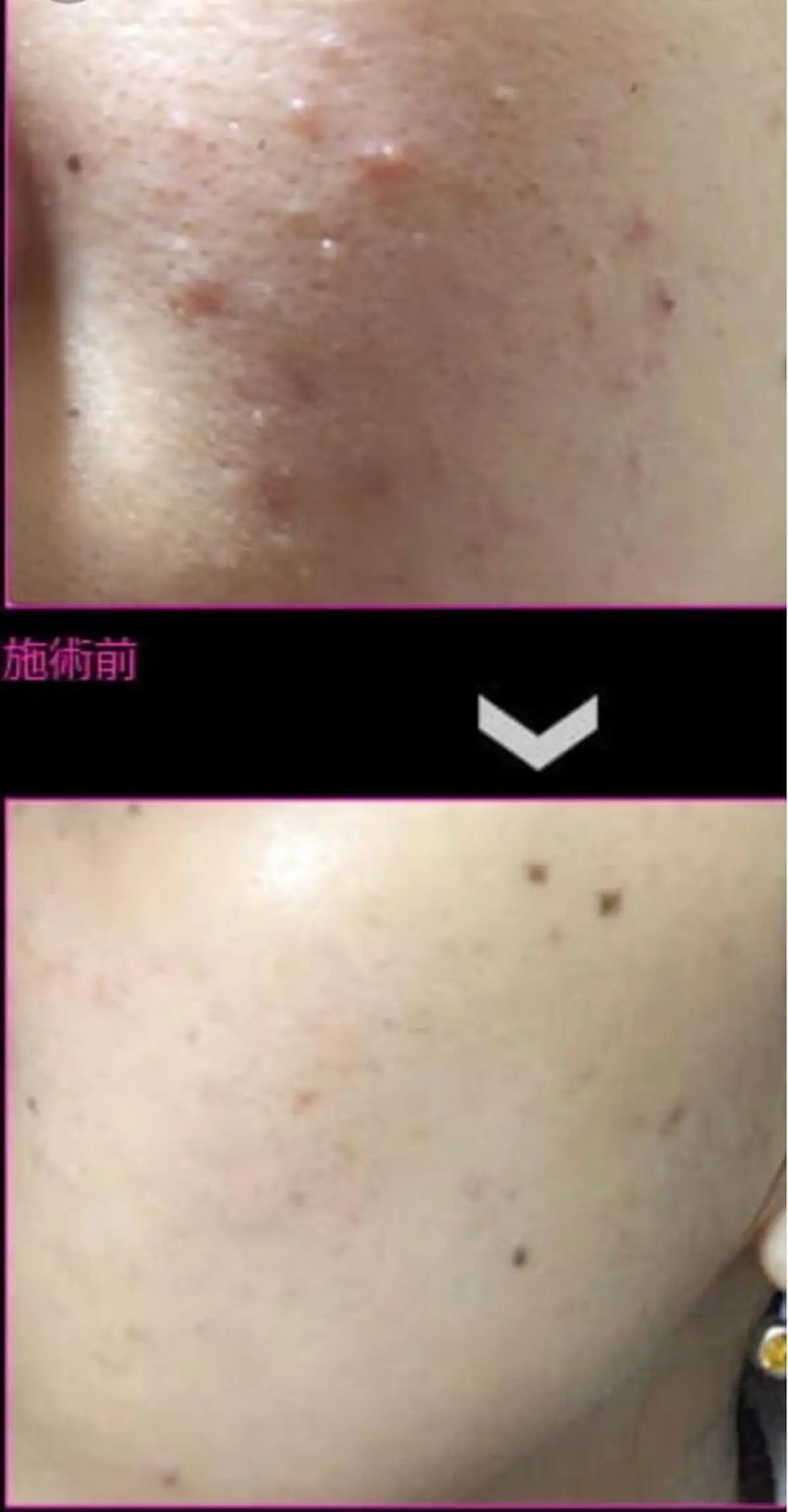 M渋谷店所属・M渋谷 ホワイトニングのエステ・リラクイメージ