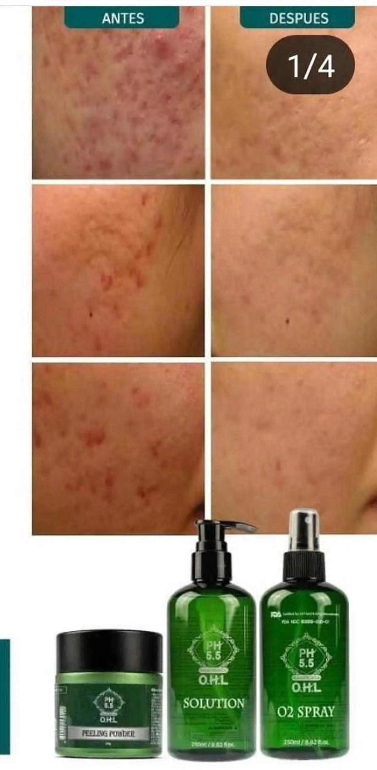 【ハイパーナイフ痩身&小顔コルギ&ハーブピーリング】K-Beauty　東新宿所属・kーbeauty痩身 フェイシャルのエステ・リラクイメージ