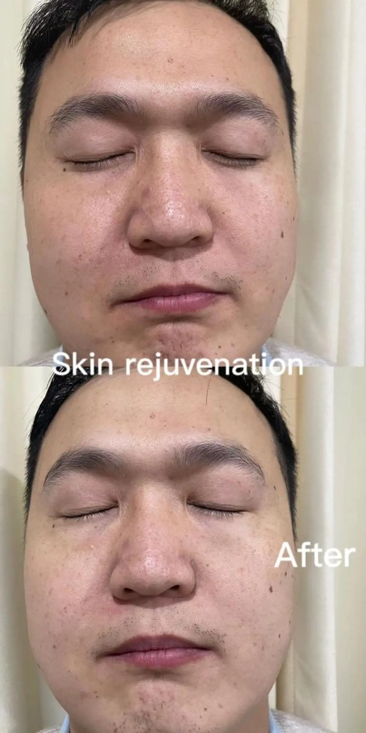 メンズ キッズ Einami 美肌痩身サロンのエステ・リラクイメージ