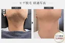 men's NOA 髭 眉毛 ミニモ特価のプロフィール画像