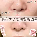 Ella【エラ】 毛穴専門サロンのプロフィール画像