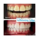 ホワイトニングサロン シフォン豊田店のプロフィール画像