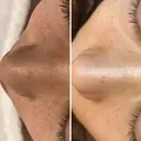 毛穴改善サロン アイスリーのプロフィール画像