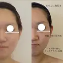 整形級の変化👀 最新✨韓国小顔管理のプロフィール画像