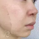 毛穴＆エイジングケア Jeweliaのプロフィール画像