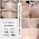 深い肌悩み専門 フェイシャルサロンのプロフィール画像