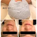 毛穴/ピーリング POLAのプロフィール画像