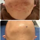 【赤ニキビ改善】 BELL'ET新宿店のプロフィール画像