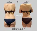 本気で痩せたい方へ 痩身専門サロンのプロフィール画像