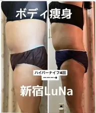 ❤️人気No1❤️痩身キャビ+全身リンパ+ヘッドスパ120分