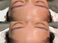 フルフェイスWAX顔脱毛+贅沢ジェルパック🫧