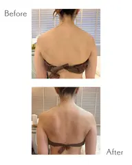 【背中 二の腕をすっきりさせたい方】ハイパーナイフ20分+ハイパーシェイプ10分