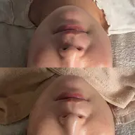 フェイシャルリンパケア
