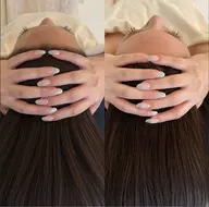 7月期間限定!頭蓋骨矯正BeforeAfter撮影投稿可能な方!