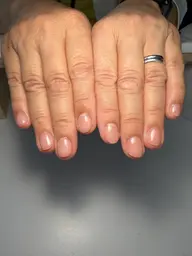 クリアネイル