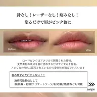 60%OFF(特典含む)【ローマピンク💋リップ】アフタークリーム3本(39,600円)+ヒアルロン酸導入プレゼント🎁