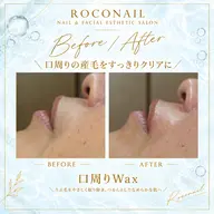 SALE対象メニュー✨【化粧ノリ・くすみ改善】大人の毛穴&角質リセット◎RICA全顔ワックス+インセルダム水分鎮静ジェル