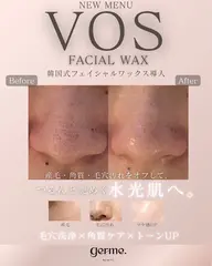 【全員｜産毛・ざらつき・くすみケア】フェイシャルワックスでつるんと透明感のある素肌へ🪞🩵