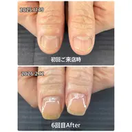 💅🏼自爪育成🌱通常コース(全７回)ホームケアセットプレゼント🎁